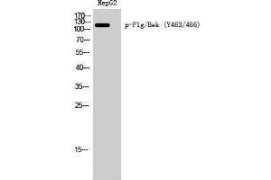 Western Blotting (WB) image for anti-FGFR1, FGFR2 (pTyr463), (pTyr466) antibody (ABIN3173105) (FGFR1/FGFR2 Antikörper  (pTyr463, pTyr466))
