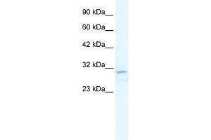 TRPM3 antibody used at 2. (TRPM3 Antikörper  (N-Term))