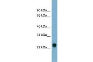 Image no. 1 for anti-Adenylate Kinase 3 (AK3) (N-Term) antibody (ABIN6741718) (Adenylate Kinase 3 Antikörper  (N-Term))