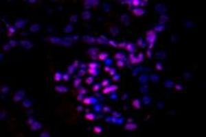 Immunofluorescent analysis of paraformaldehyde-fixed mouse kidney using p38IP (ABIN7075954) at dilution of 1: 200 (Transcription Factor SPT20 Homolog (SUPT20H) Antikörper)