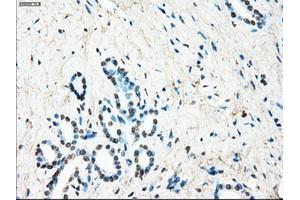 Immunohistochemical staining of paraffin-embedded Ovary tissue using anti-LTA4H mouse monoclonal antibody. (LTA4H Antikörper)