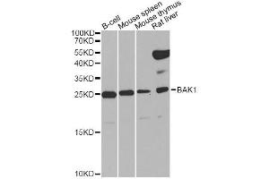 Western blot analysis of extracts of various cell lines, using BAK1 Antibody. (BAK1 Antikörper)
