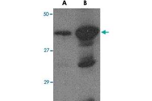 Western blot analysis of (A) 5 ng and (B) 25 ng of recombinant HA1 with Avian Influenza Hemagglutinin 2 polyclonal antibody  at 1 ug/mL .