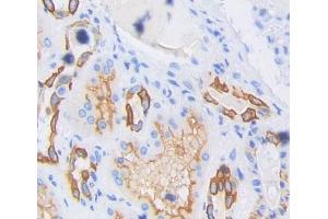 IHC-P analysis of Human Tissue, with DAB staining. (Sortilin 1 Antikörper  (AA 50-320))