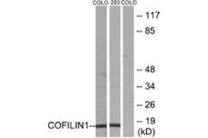 Western blot analysis of extracts from COLO205/293 cells, using Cofilin (Ab-3) Antibody. (Cofilin Antikörper  (AA 1-50))