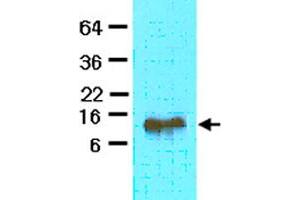 The extract of mouse heart (40 ug) was resolved by SDS-PAGE and probed with FABP4 monoclonal antibody, clone 3F4  (1:500). (FABP4 Antikörper  (AA 1-132))