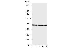 Western blot testing of BCAT2 antibody and Lane 1:  A431 (BCAT2 Antikörper  (C-Term))