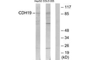 Western blot analysis of extracts from HepG2/COLO205 cells, using CDH19 Antibody. (CDH19 Antikörper  (AA 371-420))