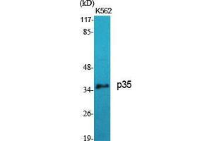 Western Blot (WB) analysis of specific cells using p35 Polyclonal Antibody. (P35 (N-Term) Antikörper)