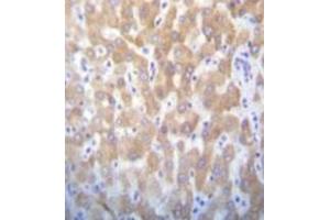 Formalin fixed and paraffin embedded human liver tissue reacted with FAST kinase (C-term) Antibody (C-term) Cat. (FASTK Antikörper  (C-Term))