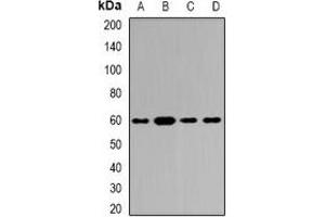 Western blot analysis of Tyrosyl-tRNA Synthetase expression in Hela (A), SKOV3 (B), mouse brain (C), rat brain (D) whole cell lysates. (YARS Antikörper)