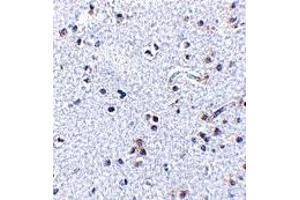 Immunohistochemistry (IHC) image for anti-Thymic Stromal Lymphopoietin (TSLP) (C-Term) antibody (ABIN1030782)