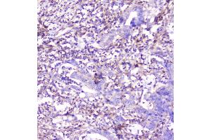 IHC analysis of ADA using anti-ADA antibody (ABIN6719272). (ADA Antikörper  (AA 135-363))
