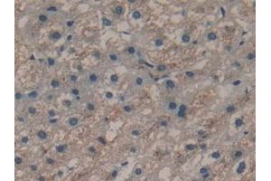 Detection of CYP-40 in Human Liver Tissue using Polyclonal Antibody to Cyclophilin 40 (CYP-40)