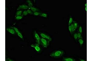 Immunofluorescent analysis of Hela cells using ABIN7152561 at dilution of 1:100 and Alexa Fluor 488-congugated AffiniPure Goat Anti-Rabbit IgG(H+L) (BRIP1 Antikörper  (AA 66-243))