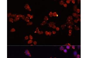 Immunofluorescence (IF) image for anti-Solute Carrier Family 25 (Mitochondrial Carrier, Adenine Nucleotide Translocator), Member 4 (SLC25A4) antibody (ABIN7009824)