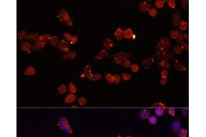 Immunofluorescence analysis of HeLa cells using SLC25A4 Polyclonal Antibody at dilution of 1:100 (40x lens).