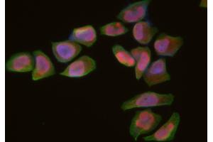 ABIN6266313 and ABIN6277430 staining Hela cells by IF/ICC. (RAD52 Antikörper  (Internal Region))