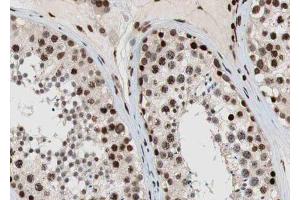 ABIN6269384 at 1/100 staining human testis tissue sections by IHC-P. (ESR2 Antikörper)
