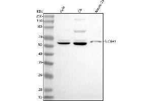 Western blot analysis of GAT1/SLC6A1 using anti-GAT1/SLC6A1 antibody (ABIN7600741).
