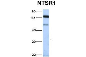 Host:  Rabbit  Target Name:  NTSR1  Sample Type:  Human Fetal Heart  Antibody Dilution:  1. (NTSR1 Antikörper  (N-Term))