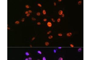 Immunofluorescence analysis of NIH-3T3 cells using Phospho-Histone H3(S10) Polyclonal Antibody at dilution of 1:100 (40x lens).