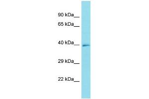 Host: Rabbit Target Name: FRMD6-AS1 Sample Type: U937 Whole Cell lysates Antibody Dilution: 1. (FRMD6-AS1 Antikörper  (C-Term))