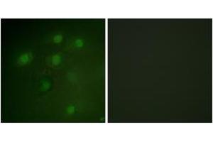 Immunofluorescence analysis of HeLa cells, using PDCD4 (Ab-457) Antibody. (PDCD4 Antikörper  (AA 420-469))