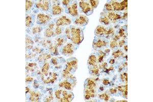 Immunohistochemistry of paraffin-embedded rat pancreas using CTRL Rabbit mAb (ABIN7266395) at dilution of 1:100 (40x lens). (Chymotrypsin Antikörper)