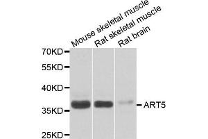 Western blot analysis of extracts of various cell lines, using ART5 antibody. (ART5 Antikörper)