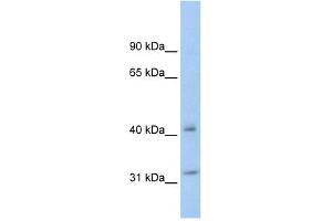 YWHAQ antibody (70R-10463) used at 0. (14-3-3 theta Antikörper  (N-Term))