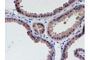 Immunohistochemical staining of paraffin-embedded Human breast tissue using anti-LECT2 mouse monoclonal antibody. (LECT2 Antikörper  (AA 19-151))
