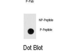 Dot blot analysis of anti-Phospho-ANTXR1-p Antibody (ABIN389930 and ABIN2839748) on nitrocellulose membrane. (ANTXR1 Antikörper  (pTyr382))