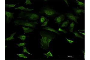 Immunofluorescence of monoclonal antibody to SNCB on HeLa cell.
