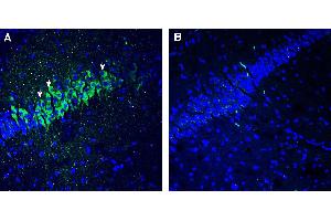 Expression of 5HT2C in mouse hippocampus. (HTR2C Antikörper  (Extracellular))
