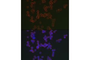 Immunofluorescence analysis of Raji cells using CD20 Rabbit pAb (ABIN7268473) at dilution of 1:150 (40x lens). (CD20 Antikörper  (AA 208-297))