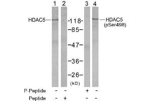 Image no. 2 for anti-Histone Deacetylase 5 (HDAC5) (pSer498) antibody (ABIN196932) (HDAC5 Antikörper  (pSer498))
