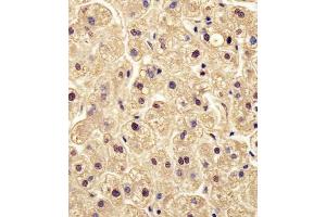 Antibody staining PGM1 in human liver tissue sections by Immunohistochemistry (IHC-P - paraformaldehyde-fixed, paraffin-embedded sections). (Phosphoglucomutase 1 Antikörper  (AA 251-282))