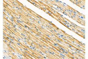 ABIN6265871 and ABIN6273338 at 1/100 staining Rat heart tissue by IHC-P.