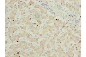 Immunohistochemistry of paraffin-embedded human liver tissue using ABIN7144733 at dilution of 1:100 (GOT2 Antikörper  (AA 33-279))