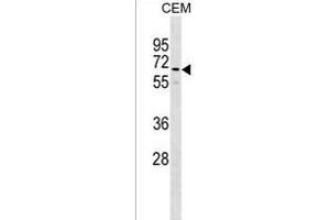 GOLGA8B Antibody (N-term) (ABIN1539112 and ABIN2850033) western blot analysis in CEM cell line lysates (35 μg/lane).
