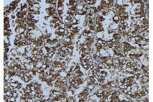 ABIN6276378 at 1/100 staining Mouse testis tissue by IHC-P.