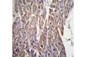 Immunohistochemistry analysis in human heart tissue (Formalin-fixed, Paraffin-embedded) using MYBPC3 Antibody (N-term), followed by peroxidase conjugated secondary antibody and DAB staining. (MYBPC3 Antikörper  (N-Term))