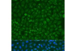 Immunofluorescence analysis of U2OS cells using COG4 Polyclonal Antibody at dilution of 1:100. (COG4 Antikörper)