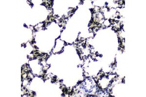IHC analysis of CES1 using anti-CES1 antibody (ABIN5693010). (CES1 Antikörper  (AA 99-206))