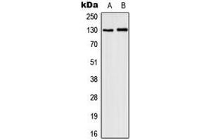 Western blot analysis of CD131 (pY593) expression in MCF7 IL1b-treated (A), HepG2 LPS-treated (B) whole cell lysates. (CD131 Antikörper  (pTyr593))