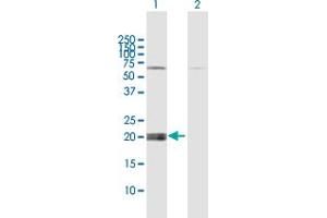 Western Blot analysis of IFNE expression in transfected 293T cell line by IFNE MaxPab polyclonal antibody. (IFNE Antikörper  (AA 1-208))