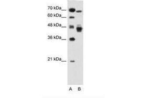 Image no. 1 for anti-Nuclear Receptor Subfamily 2, Group F, Member 6 (NR2F6) (AA 21-70) antibody (ABIN6736681) (NR2F6 Antikörper  (AA 21-70))