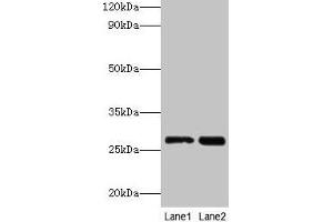 Western blot All lanes: LGALS3 antibody at 2 μg/mL Lane 1: Hela whole cell lysate Lane 2: MCF-7 whole cell lysate Secondary Goat polyclonal to rabbit IgG at 1/10000 dilution Predicted band size: 27 kDa Observed band size: 27 kDa (Galectin 3 Antikörper  (AA 2-250))