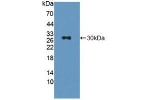 Western blot analysis of recombinant Rat LAG3. (LAG3 Antikörper  (AA 209-451))